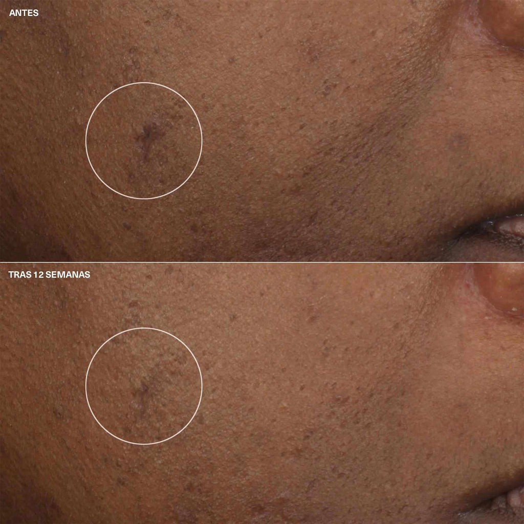 Even Better Brightening Moisturizer Creme Hydratante