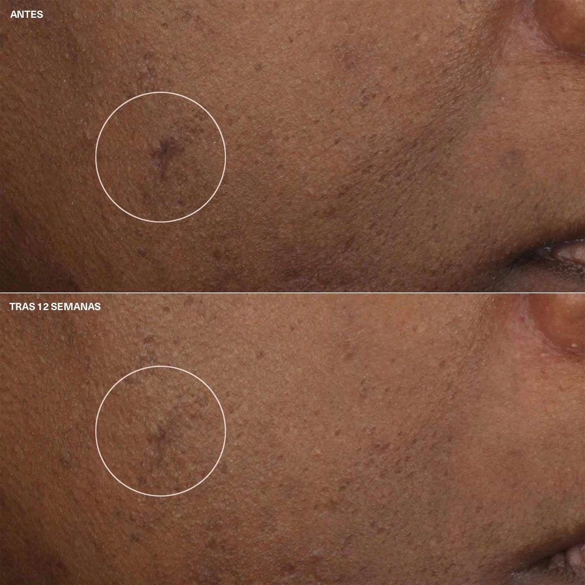 Even Better Brightening Moisturizer Creme Hydratante