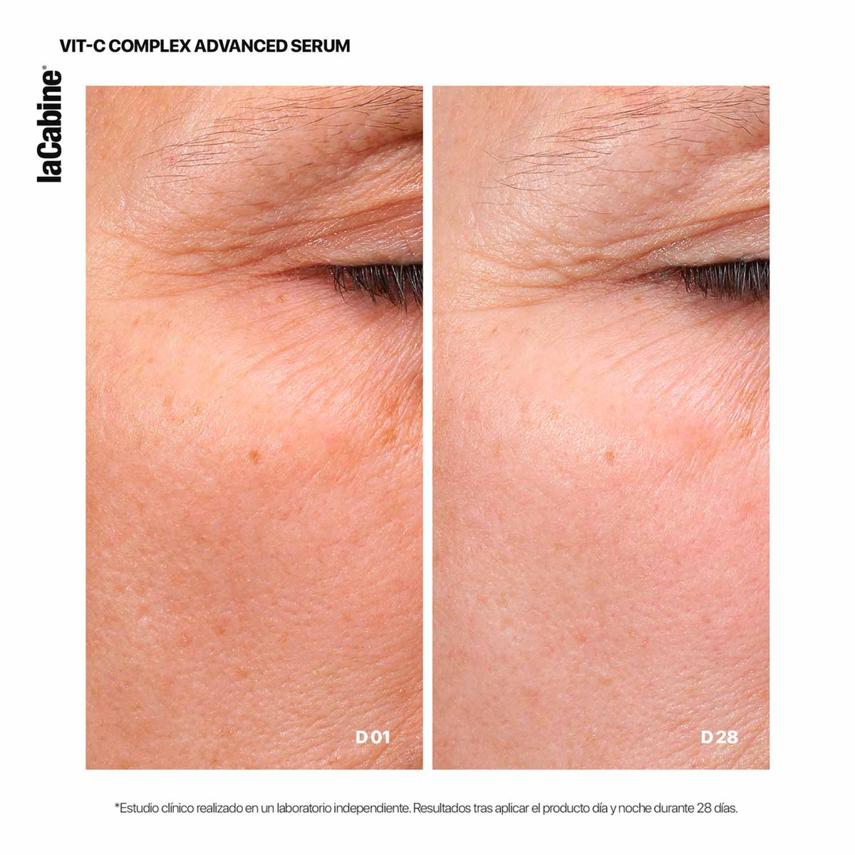 Sérum Avanzado 25% Vit-c Complex
