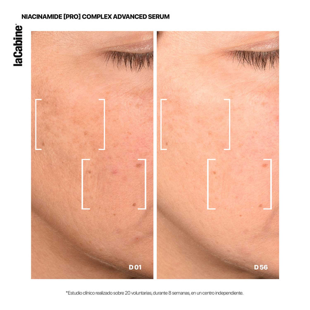 Sérum Avanzado 25% Niacinamide Pro Complex