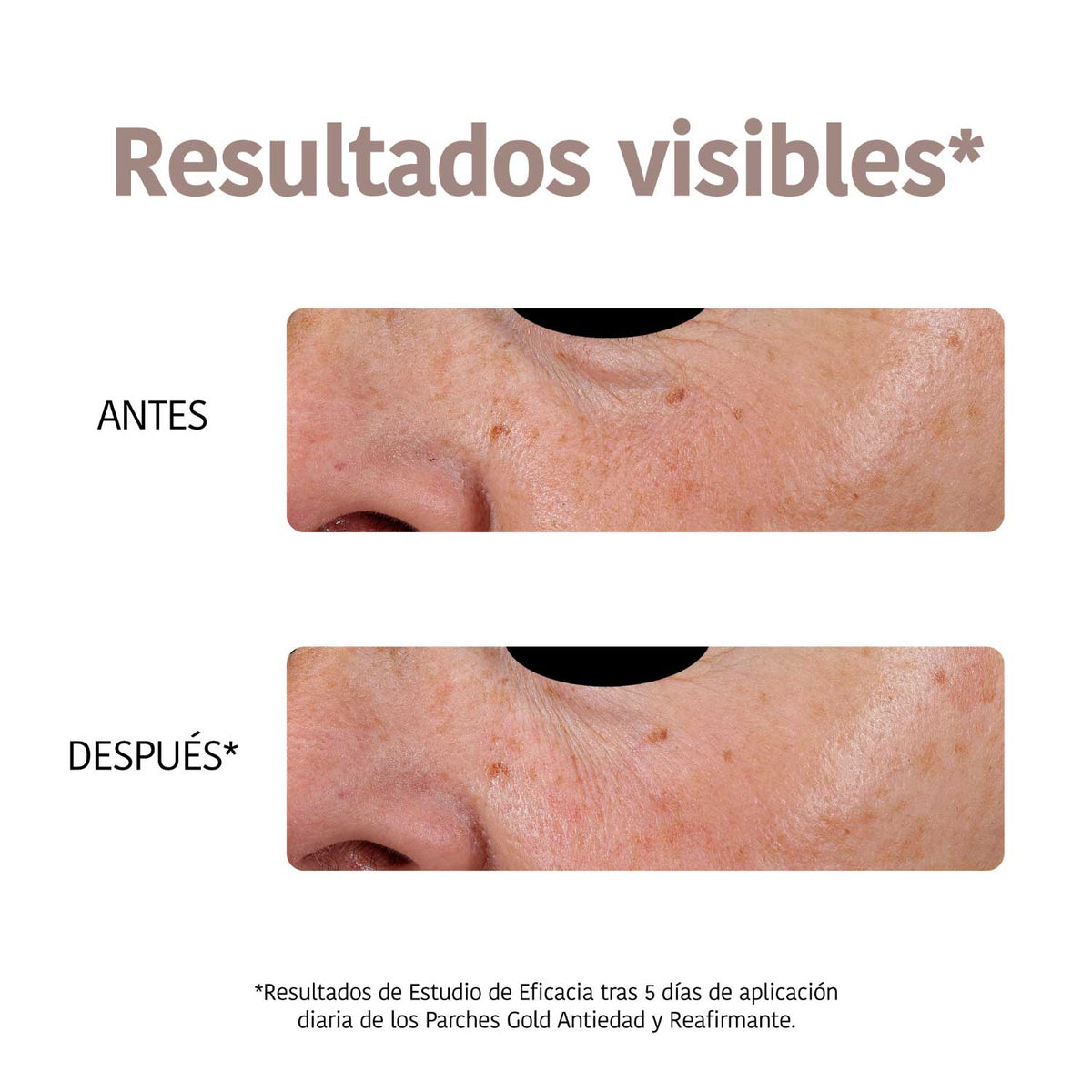 Parches Ojos Antiedad Reafirmantes Oro.