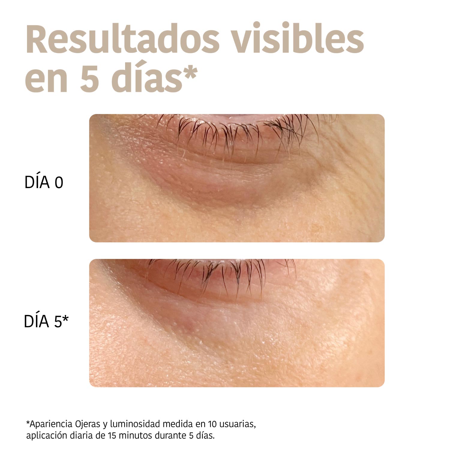 Parches Ojos Antiedad Niacinamida