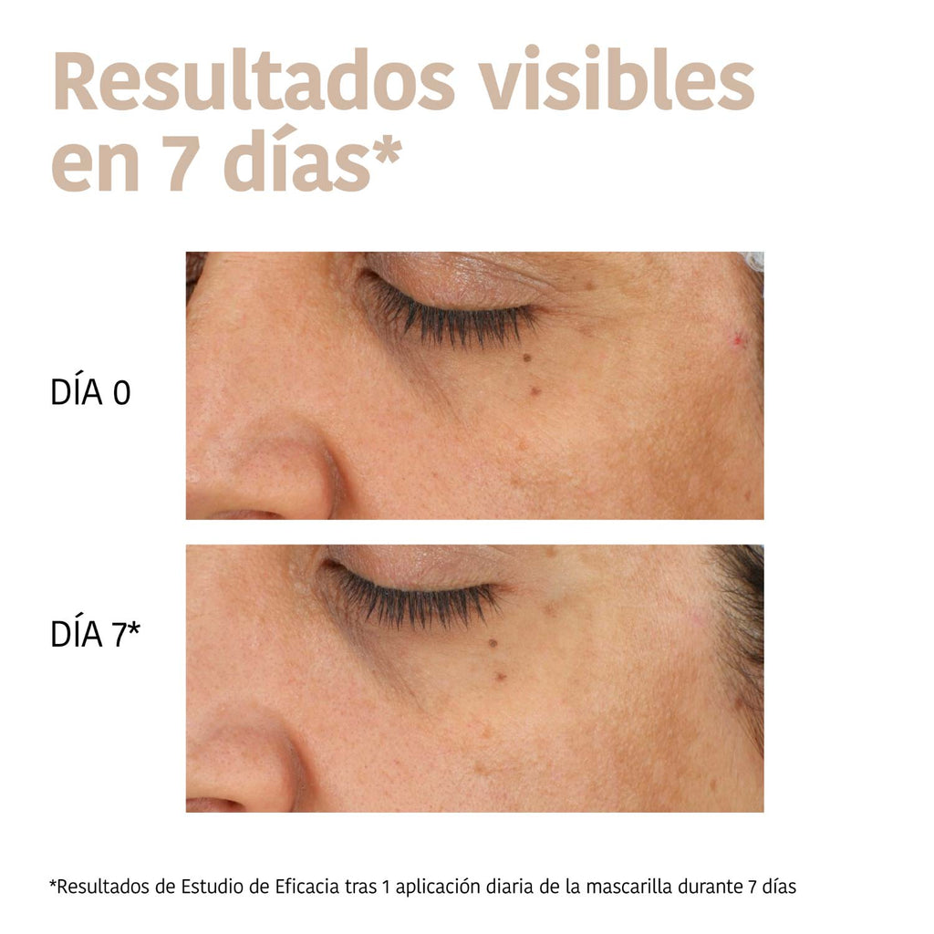 Mascarilla Antimanchas Ácido Tranexámico