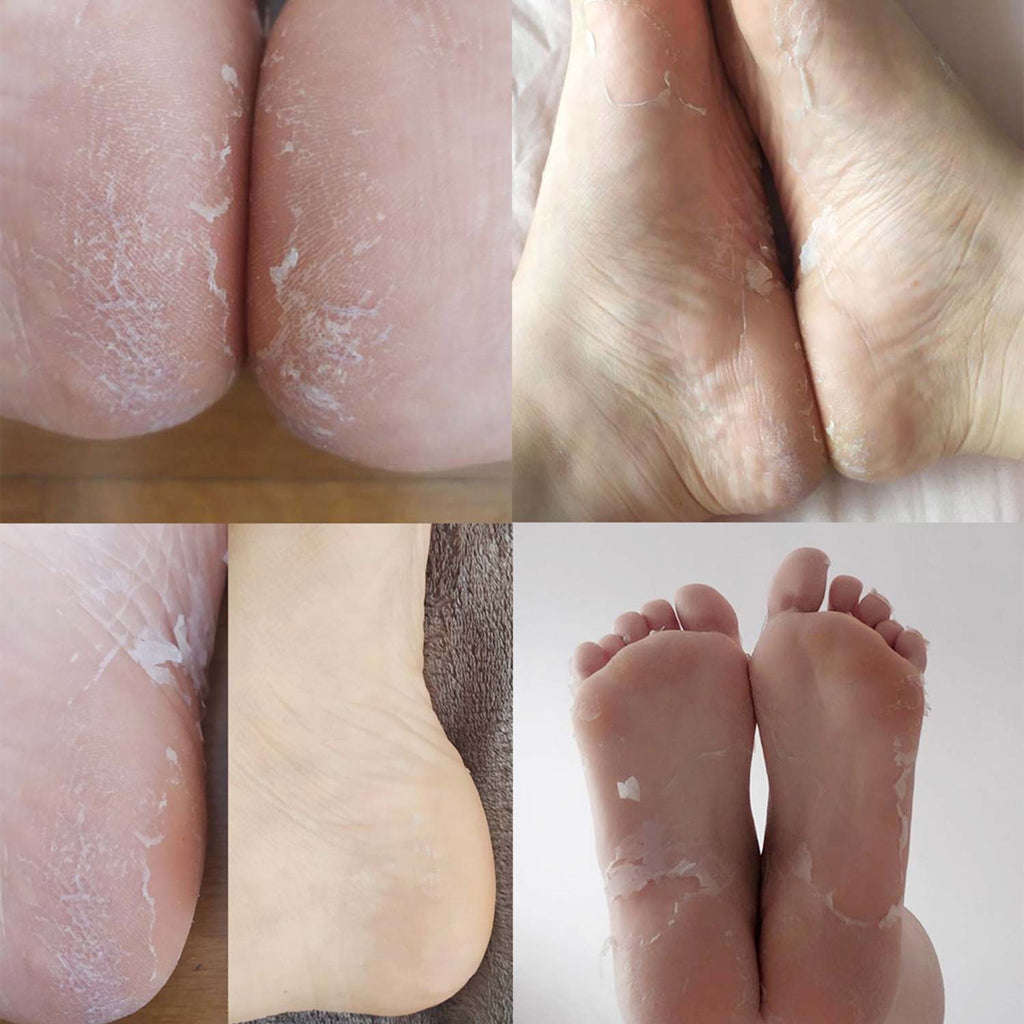 Calcetines Mascarilla Peeling y Exfoliantes