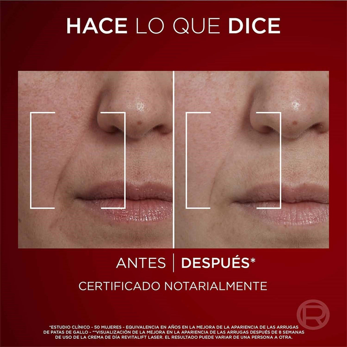 Revitalift Laser Crema Día