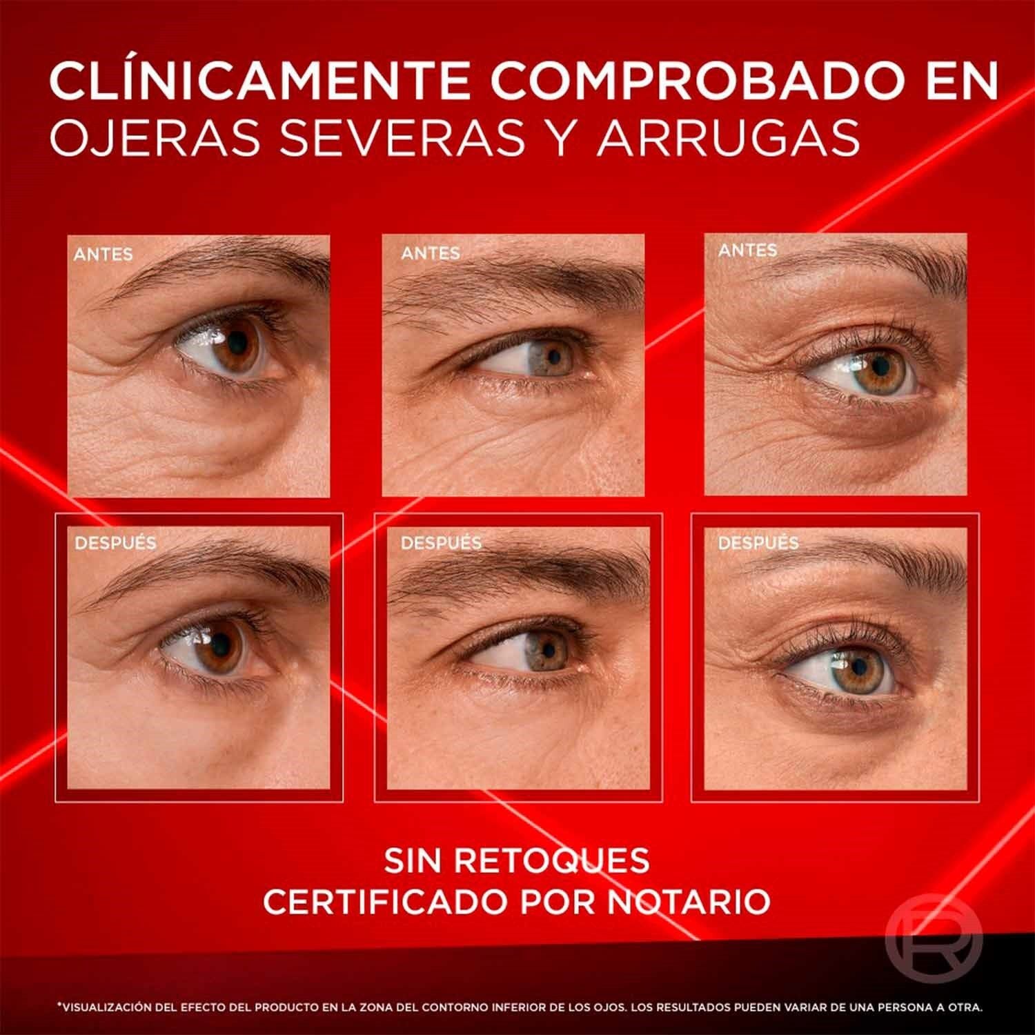 Revitalift Laser Eye Bag Eraser
